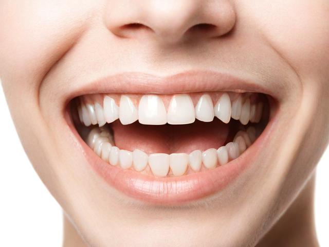 牙缝关闭技巧，轻松解决牙齿间隙问题
